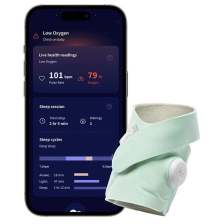 Έξυπνη βρεφική κάλτσα με αισθητήρα Owlet Dream Sock.
