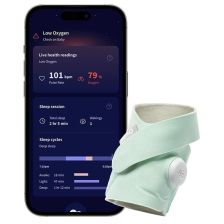 Έξυπνη βρεφική κάλτσα με αισθητήρα Owlet Dream Sock.